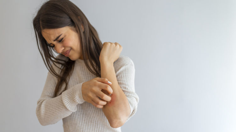 Young woman scratching arm from having itching on white background. Cause of itchy skin include insect bites, dermatitis, food/drugs allergies or dry skin. Health care concept. Close up.