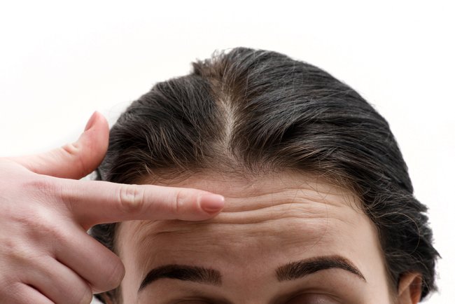 Women showing Wrinkles on forehead