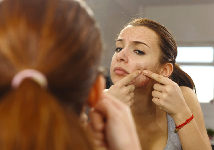 woman portrait with skin problems looking in the mirror.