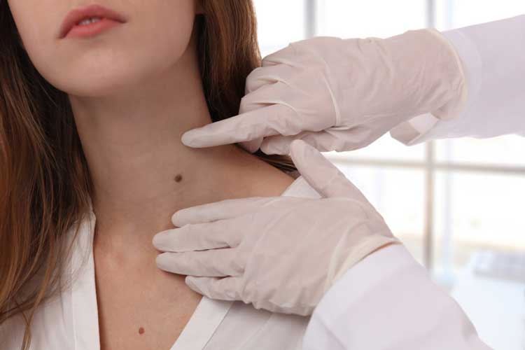 Doctor dermatologist examines birthmark of patient 