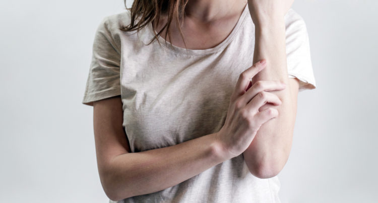 Close up view of woman scratching her arm. Health care and medical concept.