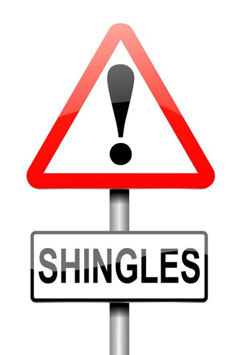 Shingles board