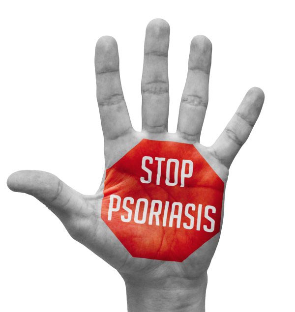 Stop Psoriasis