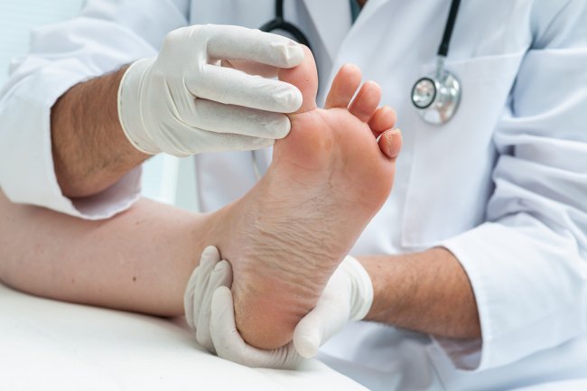 Doctor checking Athlete's foot