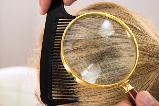 Talking care of Your Dermatologist About Hair Loss