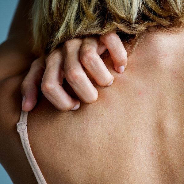 woman itching her back