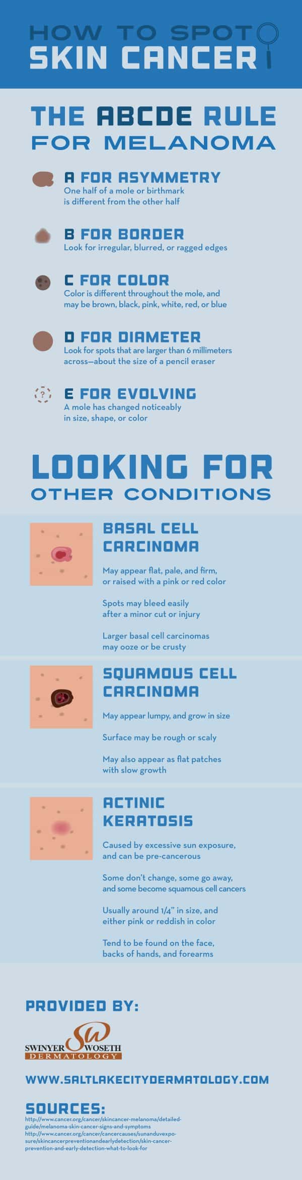 How To Spot Skin Cancer- Infographics