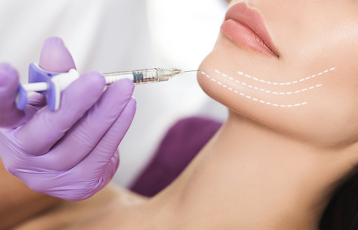 Kybella injectable in Salt Lake City, UT