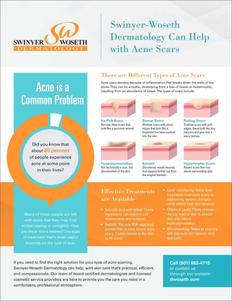 Acne scars and treatment options by Swinyer Woseth Dermatology in Salt Lake City and South Jordan.
