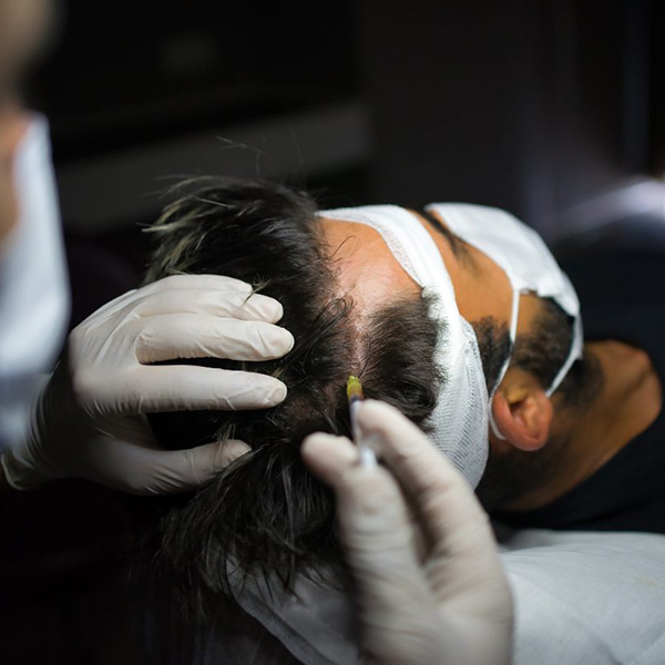 Hair Restoration with Swinyer - Woseth Dermatology
