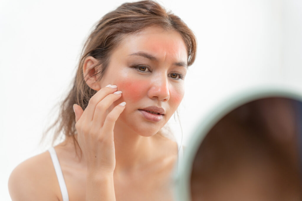 Secrets of sensitive skin care by Swinyer Woseth Dermatology in Salt Lake City and South Jordan, UT.
