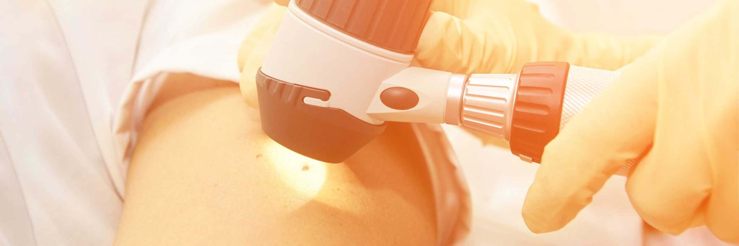 Skin cancer check-up at Swinyer-Woseth Dermatology, ensuring early detection in Salt Lake City. 