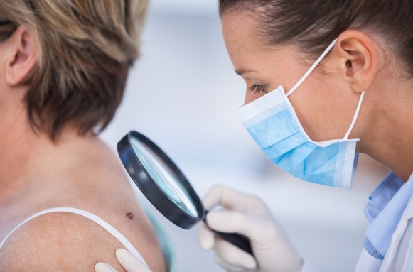 Skin Cancers in South Jordan City