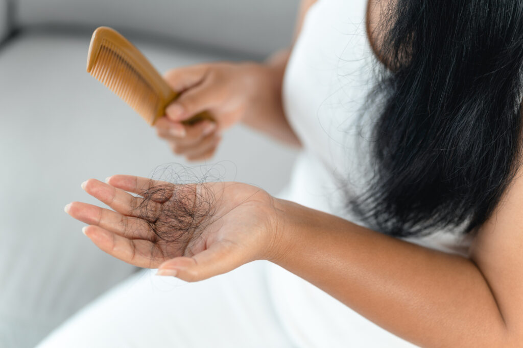 Tips to prevent hair loss by Swinyer Woseth Dermatology in Salt Lake City & South Jordan, UT.

