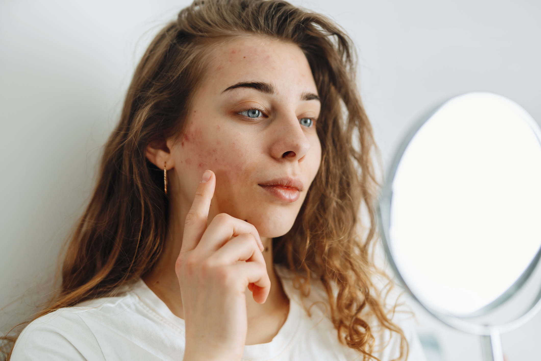 glutathione purging What's the Difference Between Skin Purging and a Breakout?