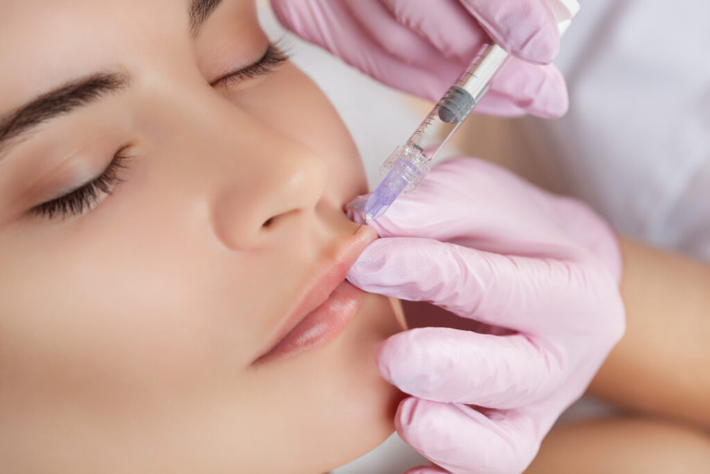 Plumping lips procedure at Swinyer Woseth Dermatology in Salt Lake City & South Jordan, UT.
