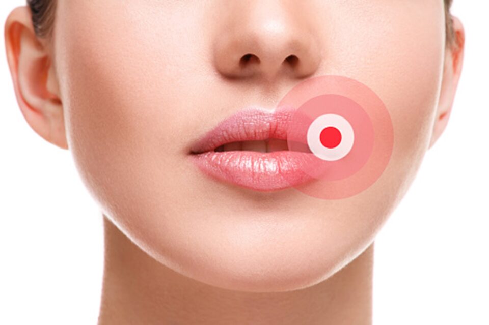 Close-up of a person's lips with a red circle on her mouth