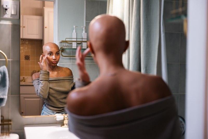 A woman with alopecia looking at herself in the mirror by Swinyer Woseth Dermatology