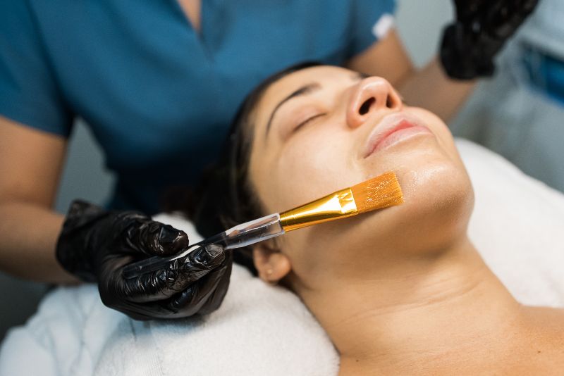 A woman receiving a chemical peel by Swinyer Woseth Dermatology