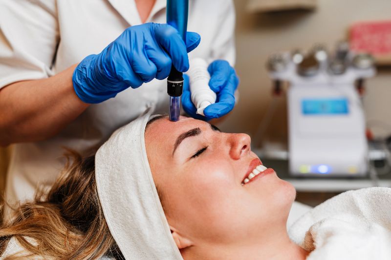 A woman receiving microneedling treatment by Swinyer Woseth Dermatology