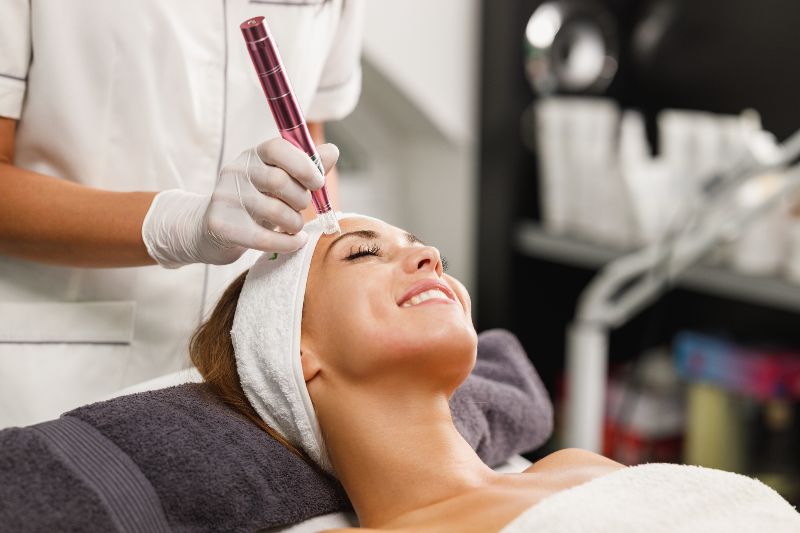A woman receiving a microneedling treatment by Swinyer Woseth Dermatology
