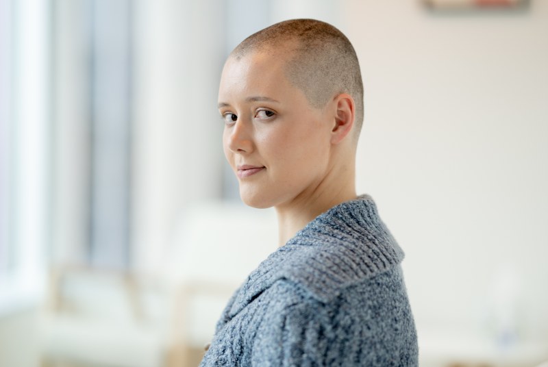 A woman with alopecia areata, looking at the camera by Swinyer Woseth Dermatology