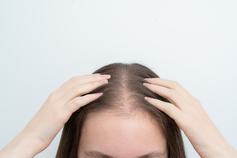 A woman touching her scalp, showing possible hair loss by Swinyer Woseth Dermatology